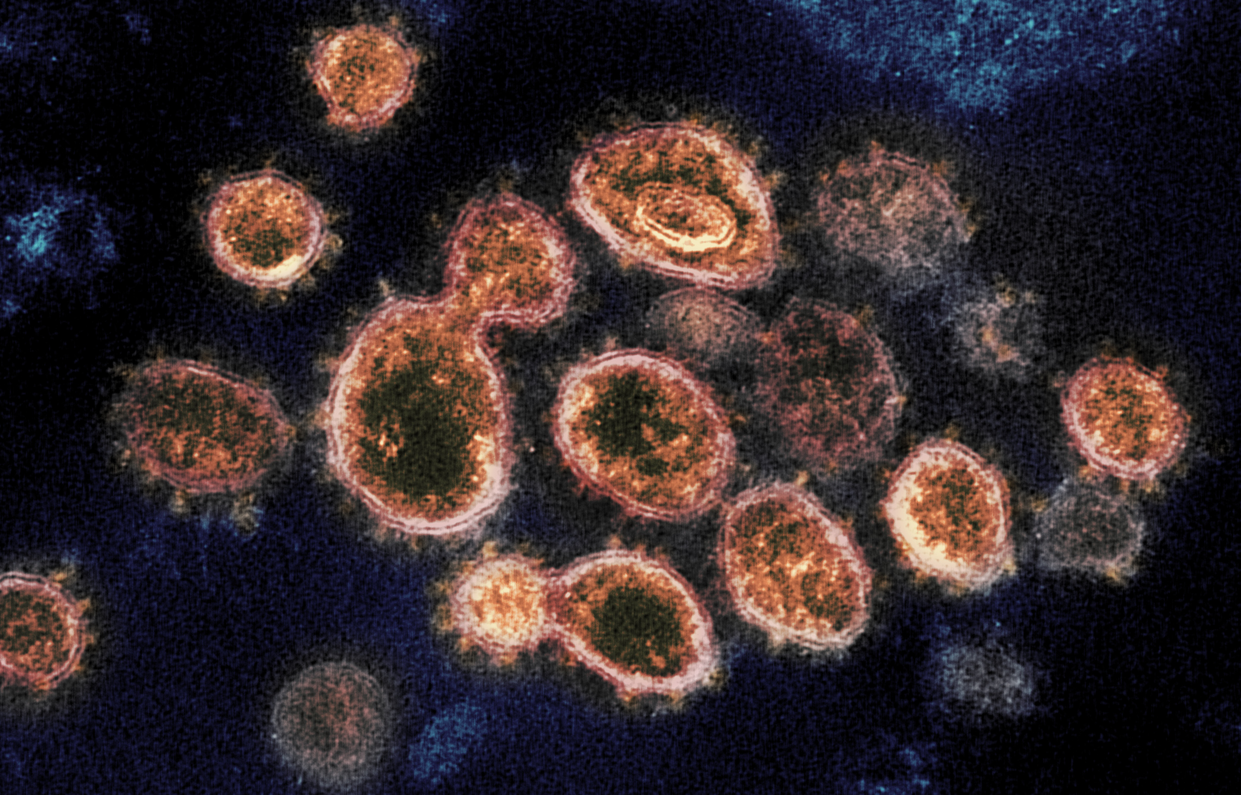 University creates task force to handle coronavirus threat, cancels travel abroad trips